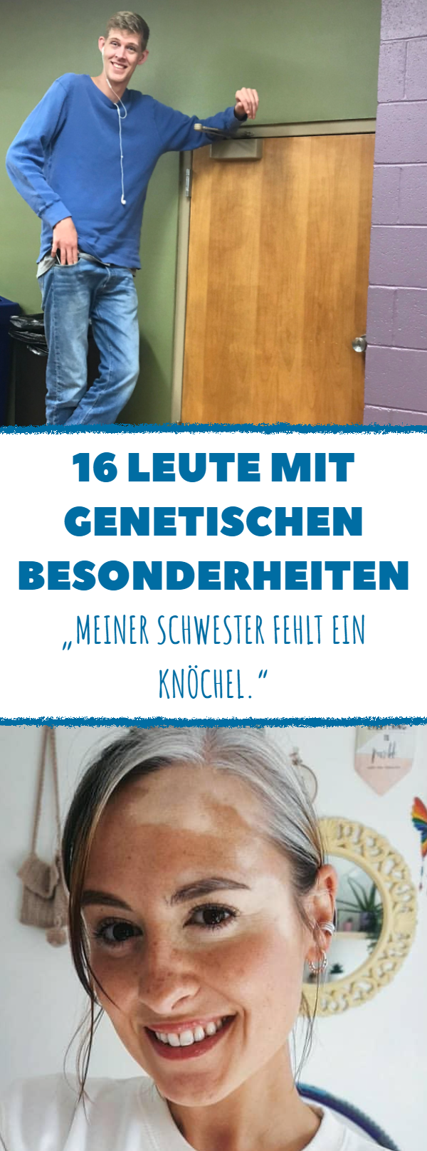 15 Leute mit genetischen Besonderheiten