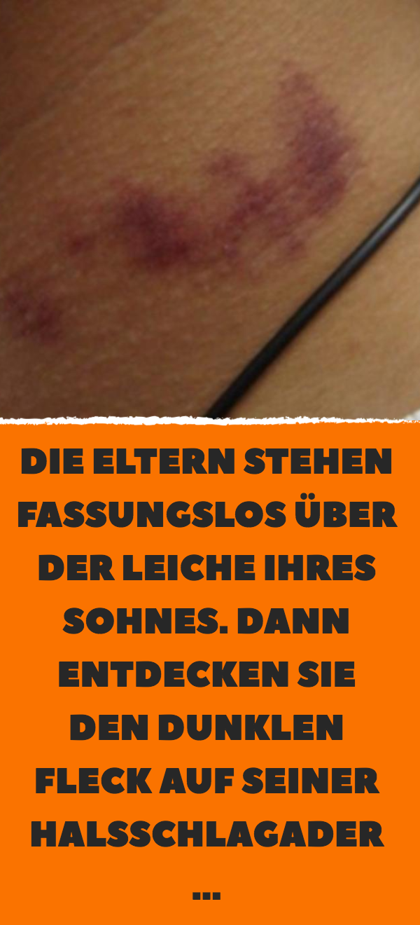 Die Eltern stehen fassungslos über der Leiche ihres Sohnes. Dann entdecken sie den dunklen Fleck auf seiner Halsschlagader …