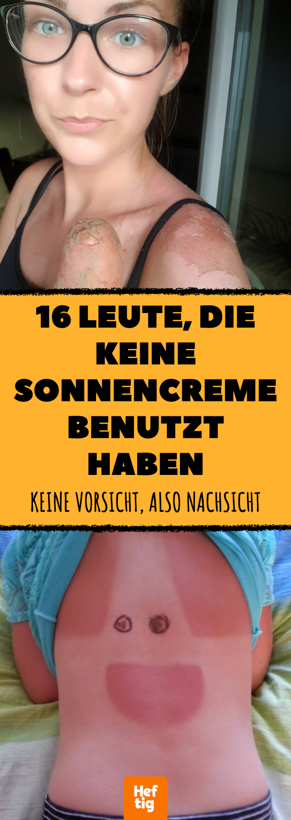 15 Leute, die keine Sonnencreme benutzt haben