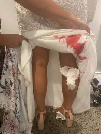 Blutegel unter Hochzeitskleid