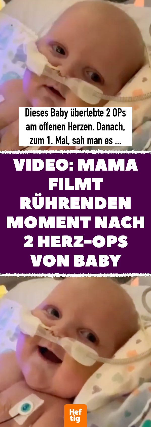 Video: Mama filmt rührenden Moment nach OP von Baby