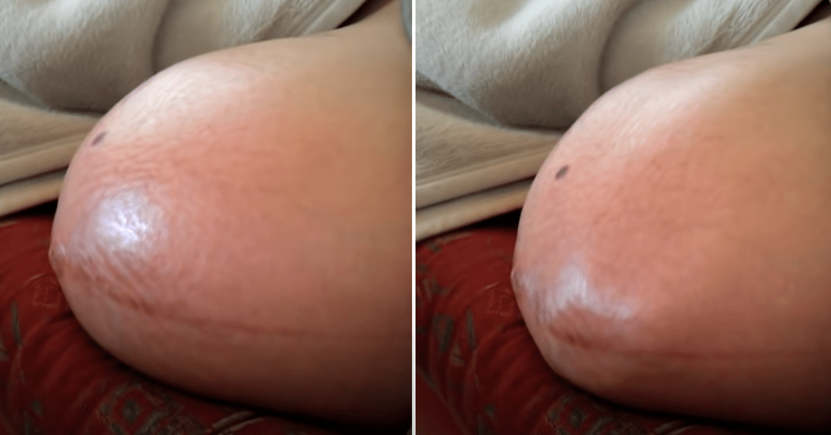 Schwangere zeigt riesigen Babybauch mit ungeborenen Zwillingen