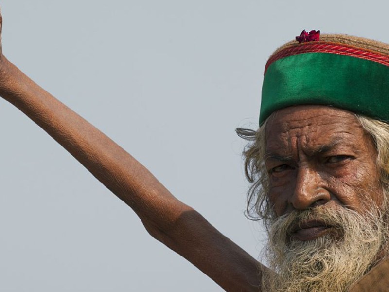 Nach 50 Jahren: Arm von Inder gibt Rätsel auf
