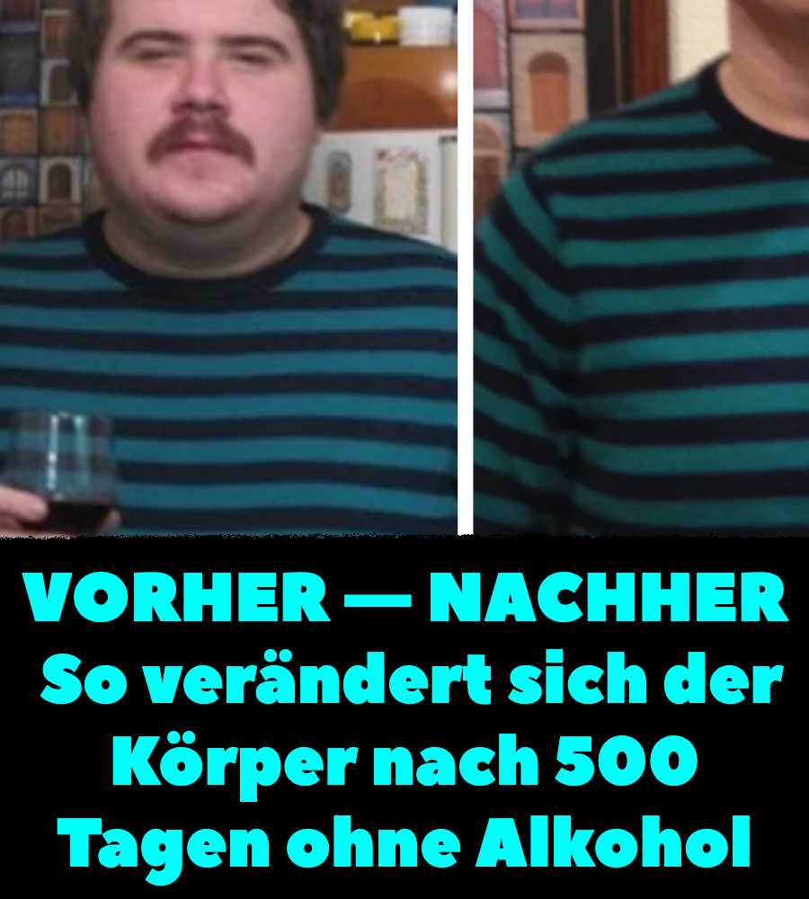Vorher nachher Mann zeigt Körper nach 500 Tagen ohne Alkohol Heftig