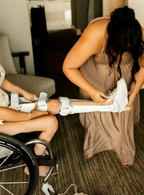 Das geschiente Bein einer Frau im Rollstuhl wird von einer Frau im Kleid angehoben.