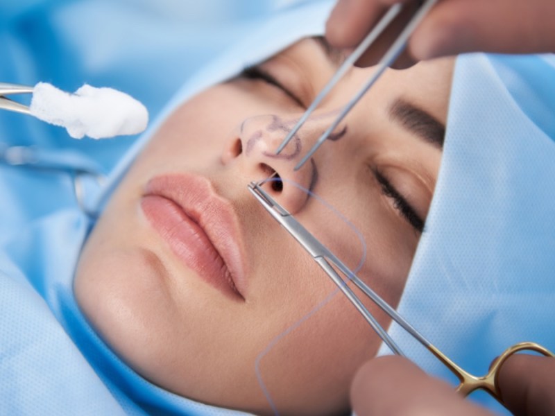 Nahaufnahme einer Frau mit schönen Lippen im Operationssaal. Arzt in Handschuhen hält medizinisches Instrument während einer Nasenkorrektur.