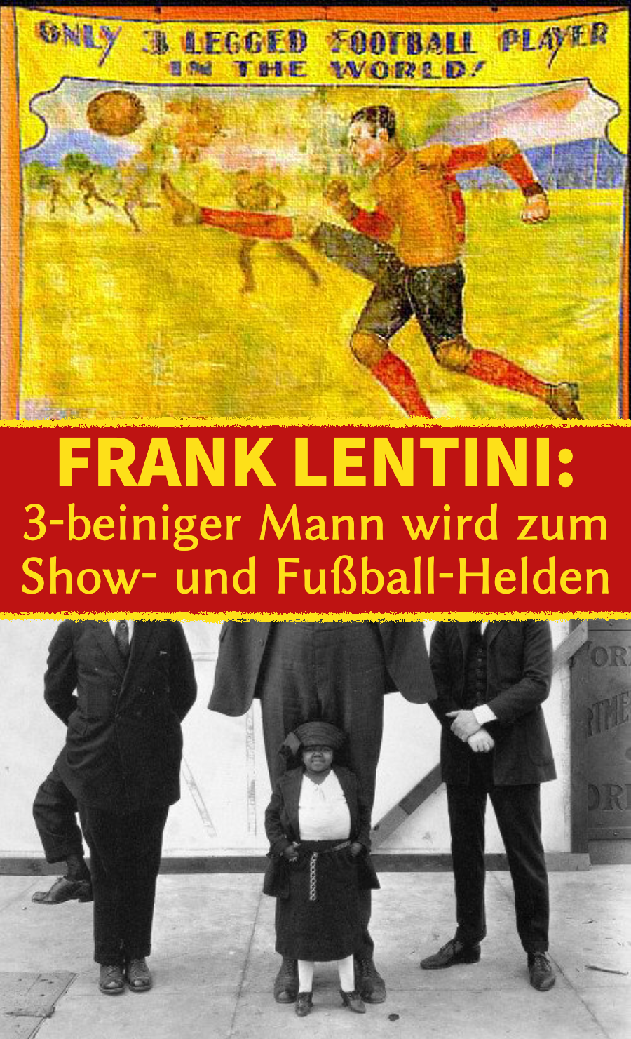 Mit 3 Beinen und zwei Genitalien wird Frank Lentini berühmt